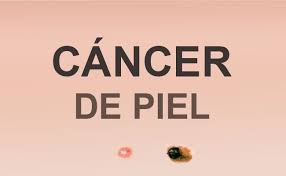 Tumores malignos de la&nbsp;piel