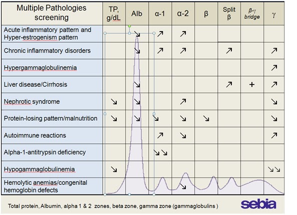 Resultado de imagen para proteinograma electroforetico tipos