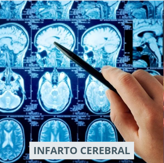 ❓ Doctor, ¿qué es el infarto cerebral?&nbsp;#DoctorPorQué