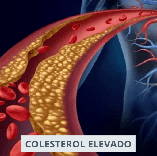 ❓ Doctor, ¿qué es la hipercolesterolemia? #DoctorPorQué